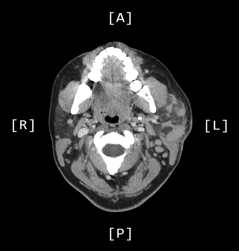 Figure 3: