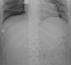 Fig. 1b
