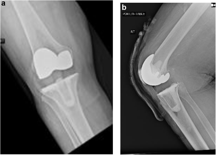 Figure 2