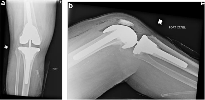 Figure 3