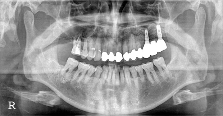 Fig. 13