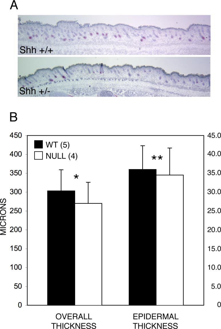 Fig. 11