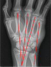 Fig. 2