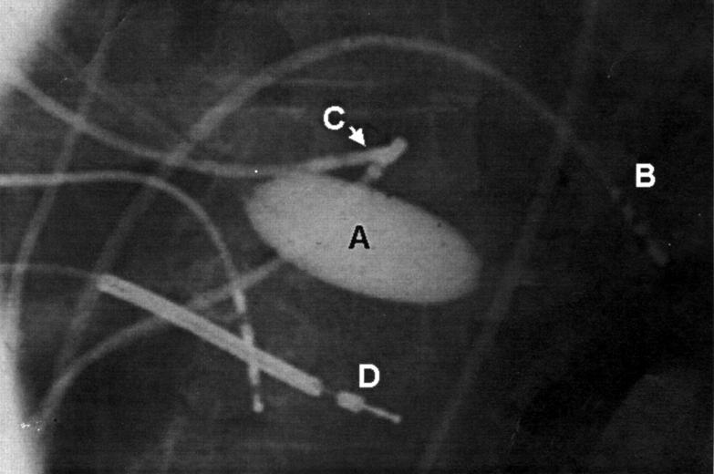 Figure 4  