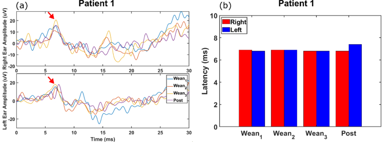 Fig. 11.