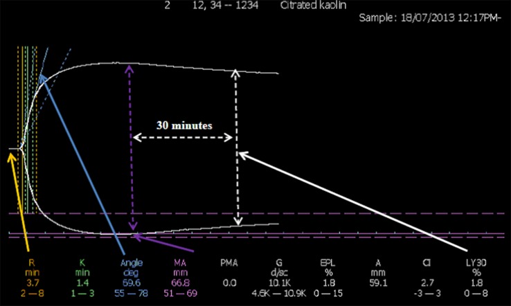 Fig. 1