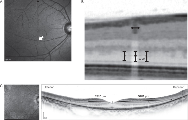 Fig. 2