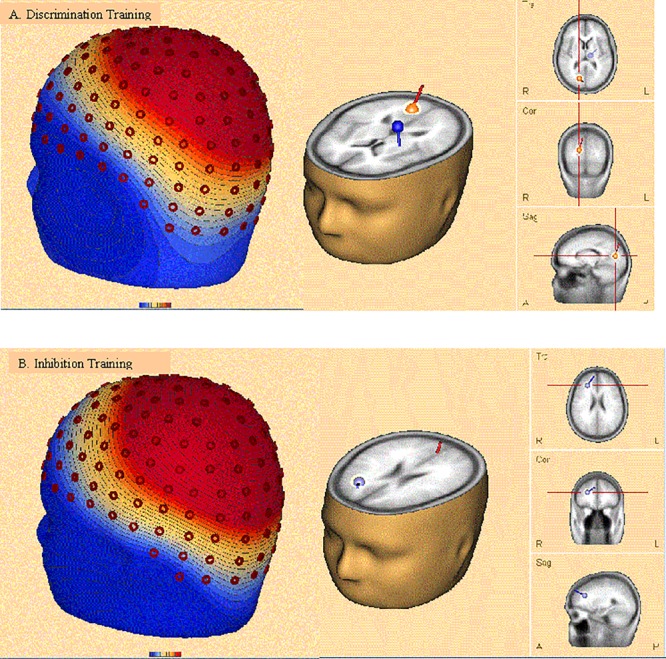 FIGURE 12