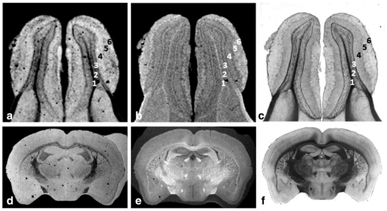 FIG. 6