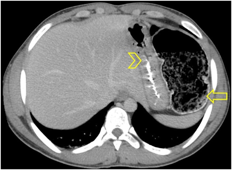 Fig. 2