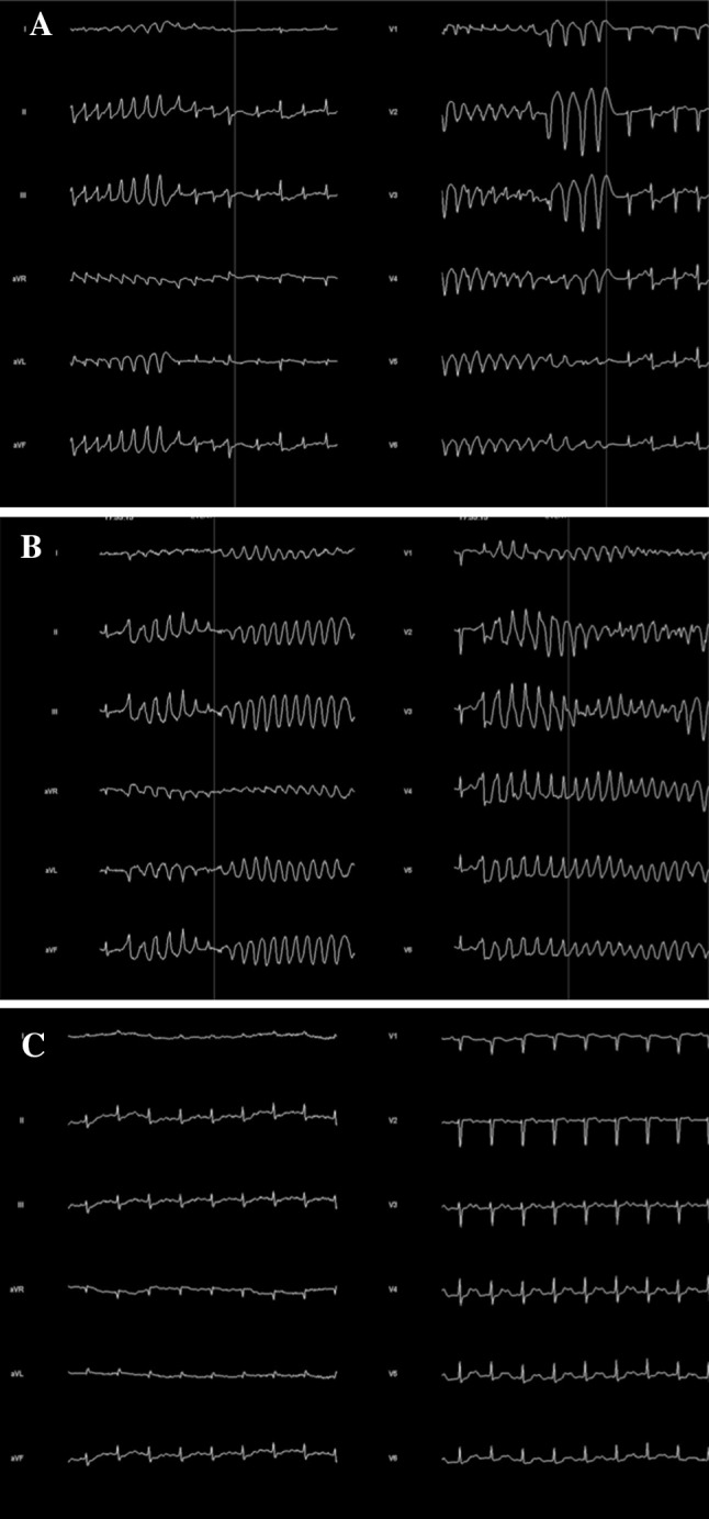 Fig. 1