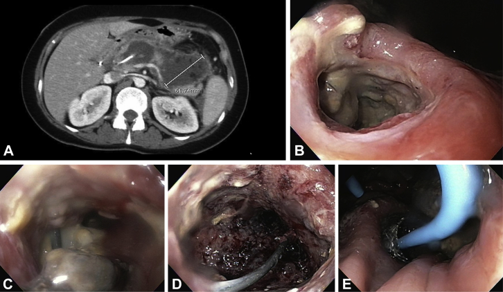 Figure 1