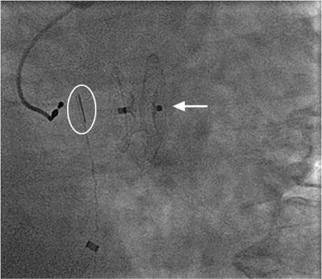 Fig. 4.