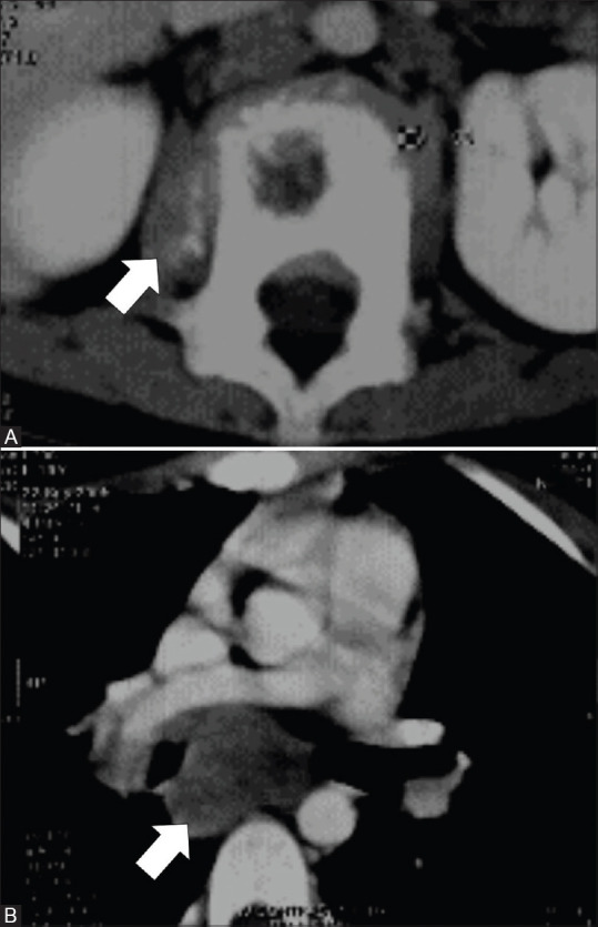 Figure 2(A and B)