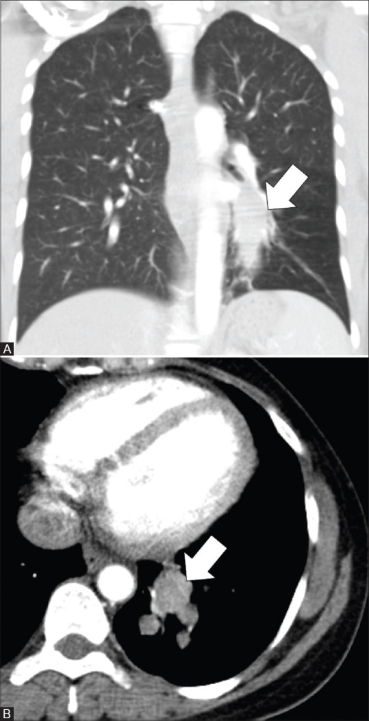 Figure 3(A and B)