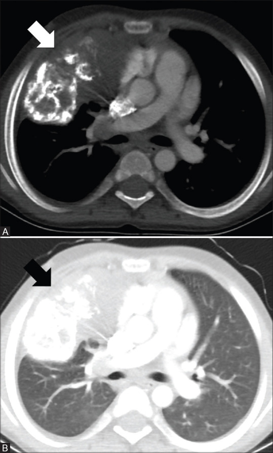 Figure 1(A and B)