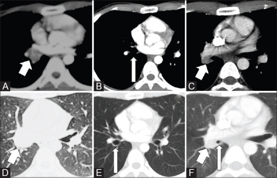 Figure 5(A-F)