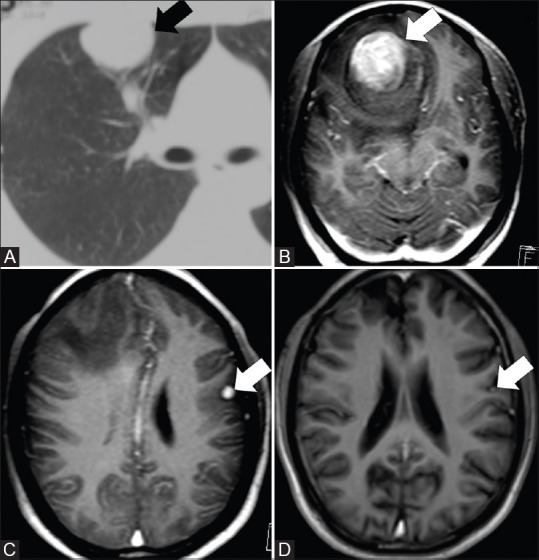 Figure 4(A-D)