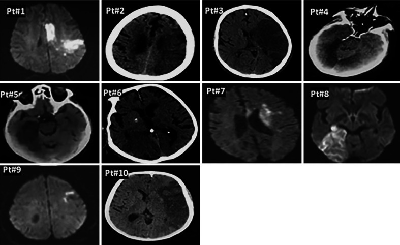 Fig. 1