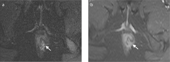 Figure 6. a, b