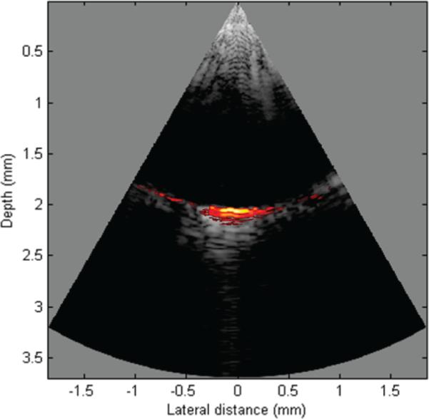 Fig. 12