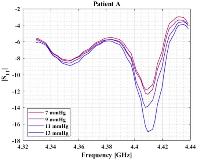 Fig. 4