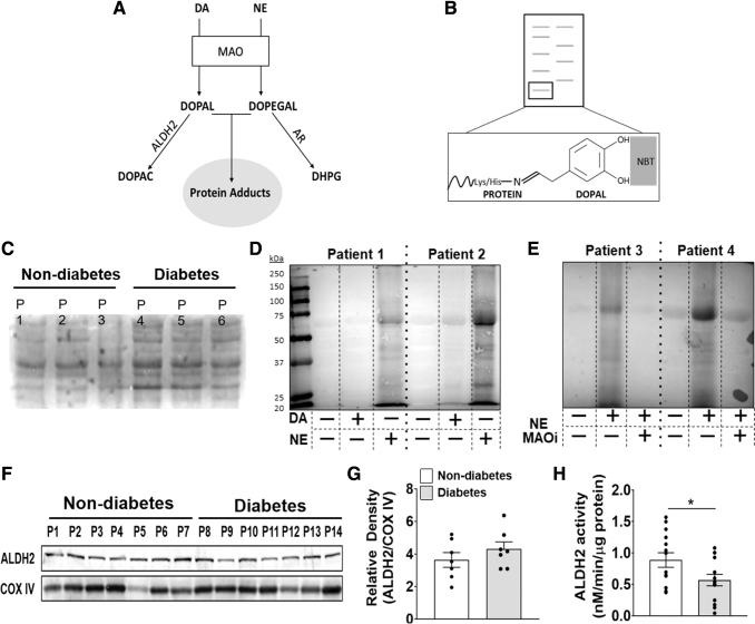 Enhanced Catecholamine Flux And Impaired Carbonyl Metabolism Disrupt