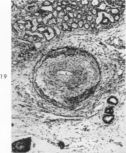 Fig. 19