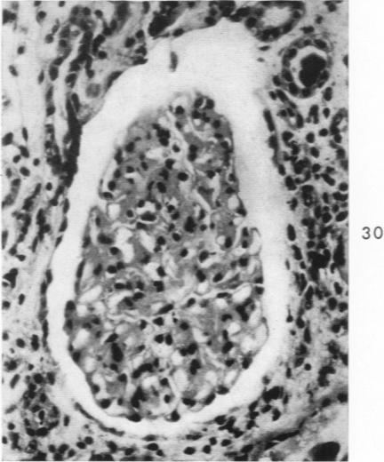 Fig. 30