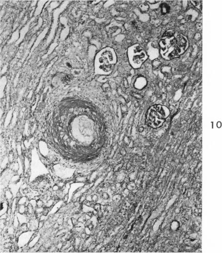 Fig. 10