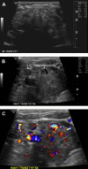 Fig. 2