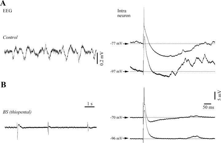 Figure 11.