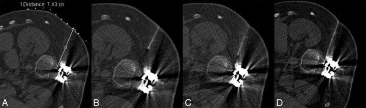 Fig 3.