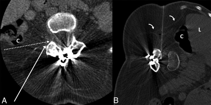 Fig 4.