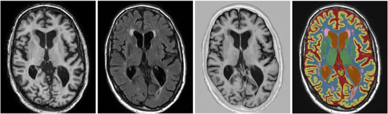 Fig. 10