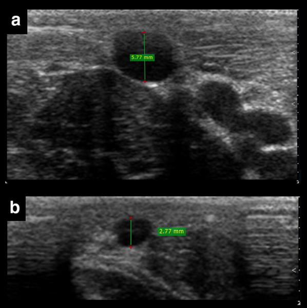 Fig. 4