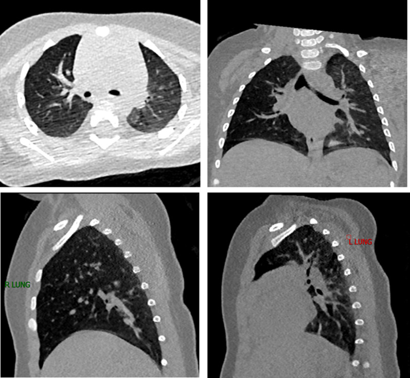 Fig. 1