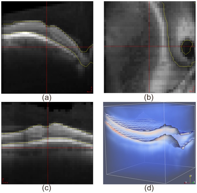 Figure 14