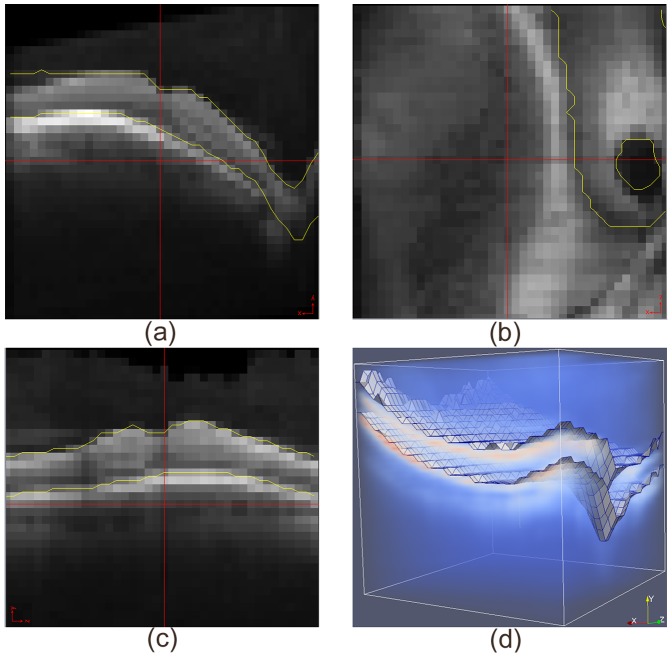 Figure 13