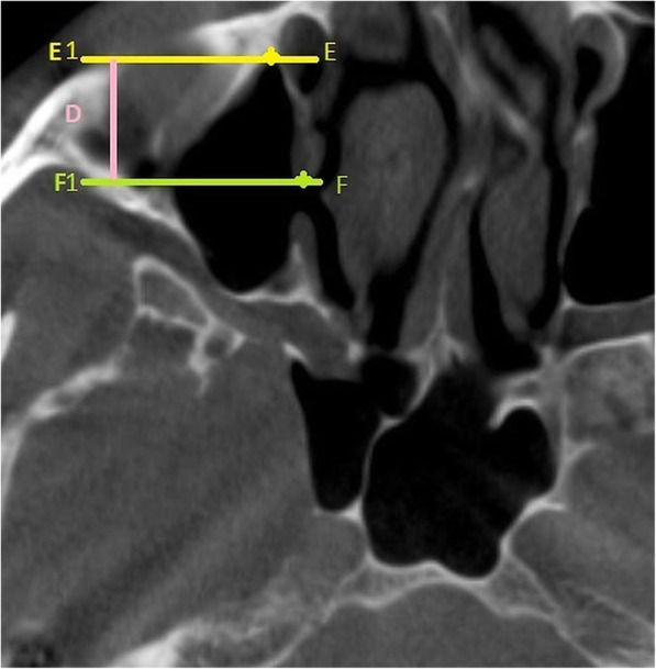 Fig. 3