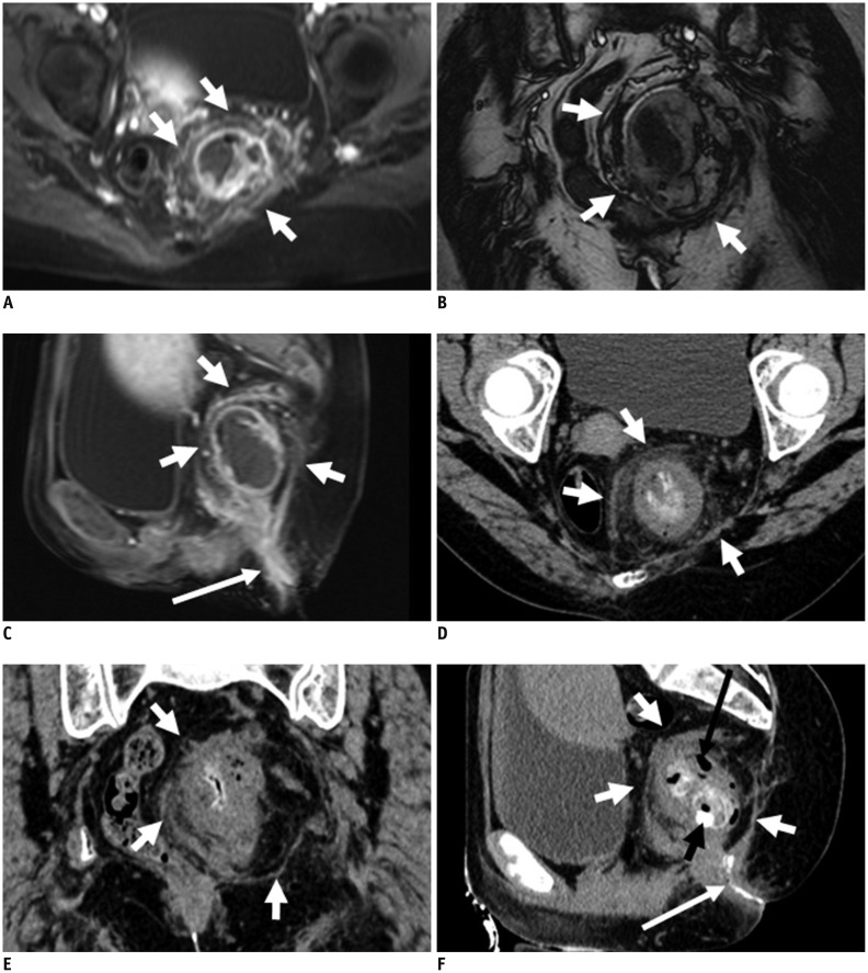 Fig. 11