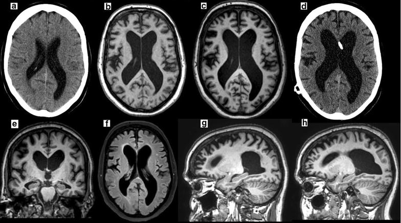 Fig. 1