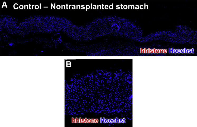 Figure 13