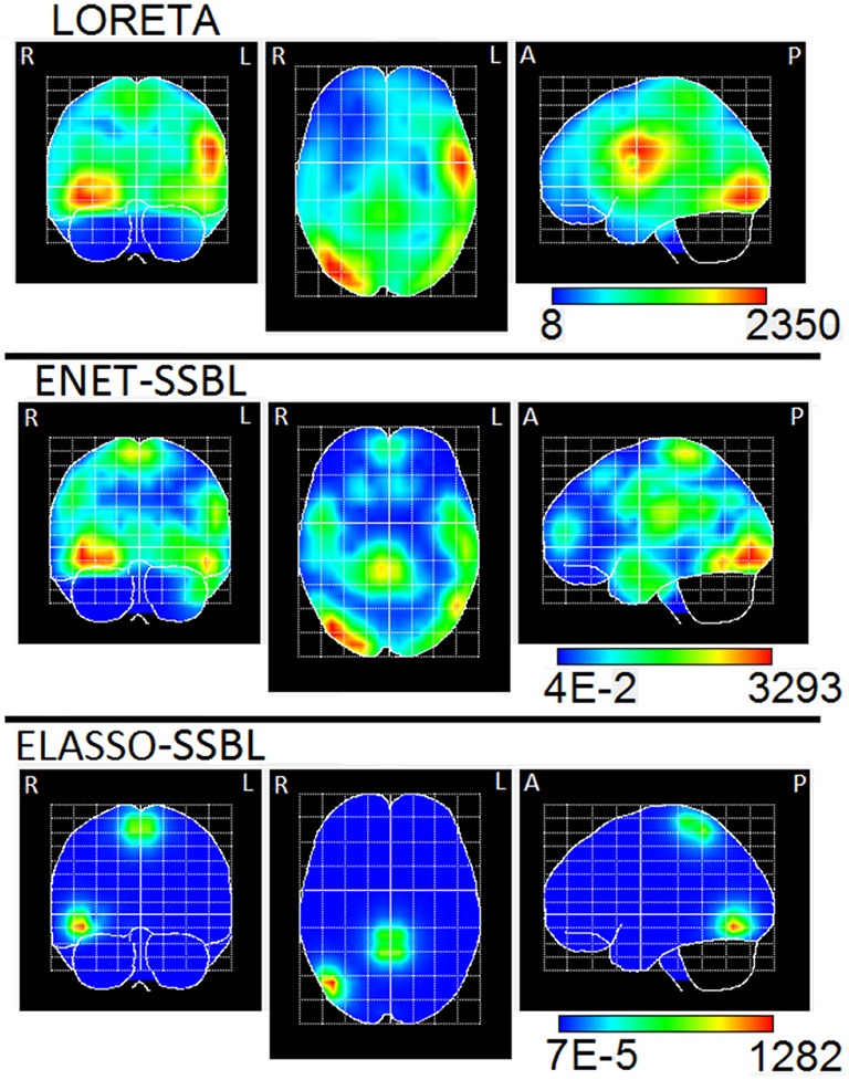 Figure 12