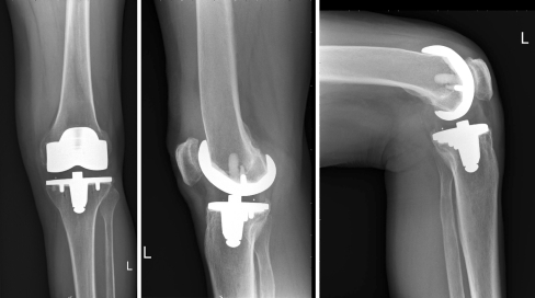 Fig. 2