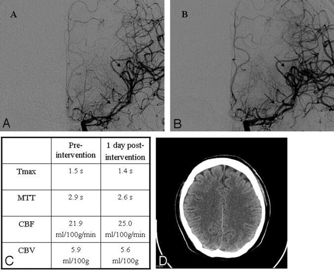 Fig 4.