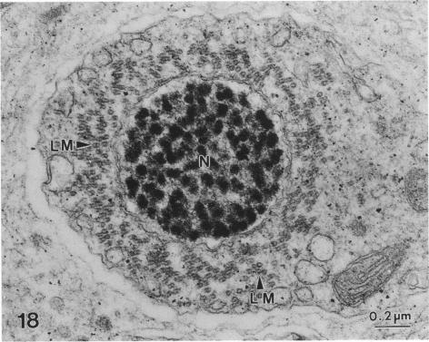 Fig. 18