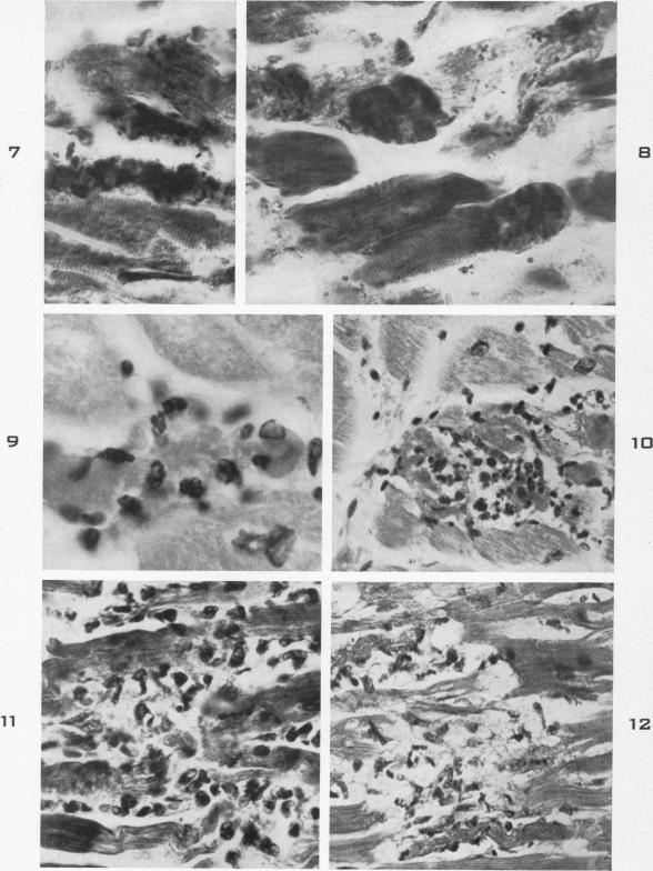 Fig. 7 to 12