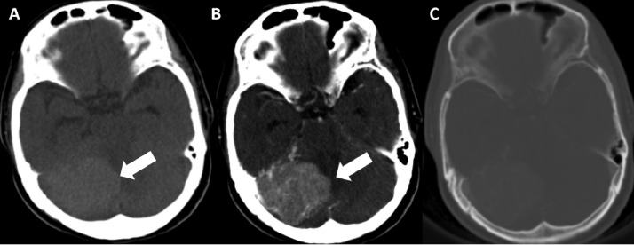 Fig 1