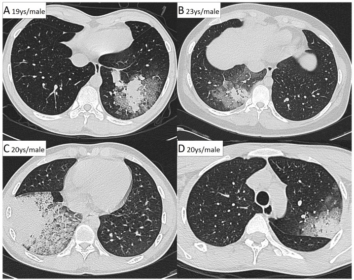 Fig 3